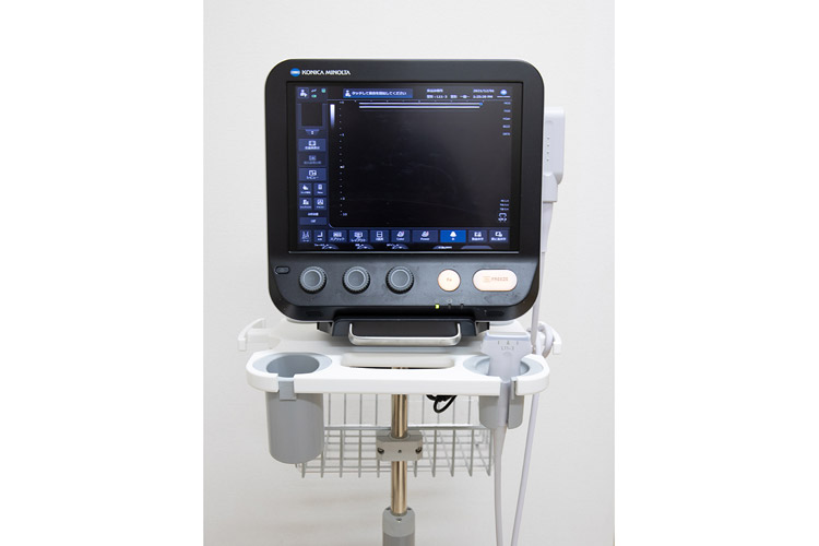 整形外科超音波診断装置(SONIMAGE MX1)イメージ
