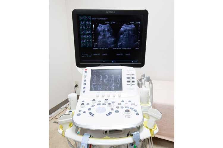 内科超音波診断装置(ARIETTA)イメージ