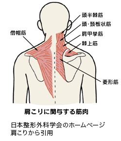 肩こりに関与する筋肉のイメージ（日本整形外科学会HP 肩こり から引用）
